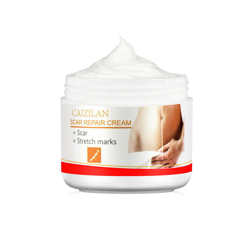 Crème réparatrice de cicatrices d'acné pour femmes enceintes, soins de la peau, 30g