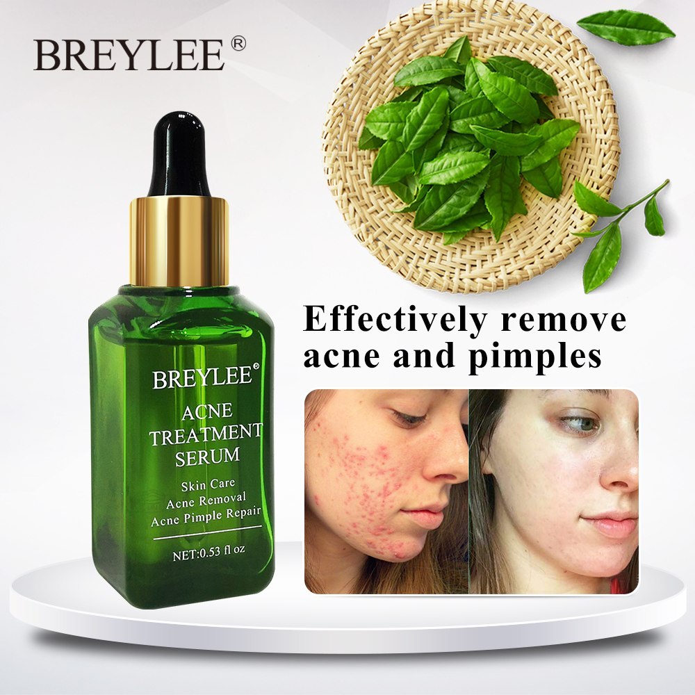 Acne Treatment Serum Face Facial Anti Acne Scar Removal Cream Skin Care Whitening Repair Pimple Remover For Acne