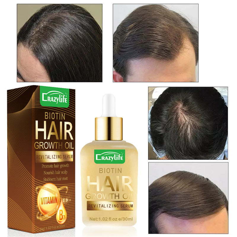 Ätherisches Haarpflegeöl 30ml Weich und erfrischend