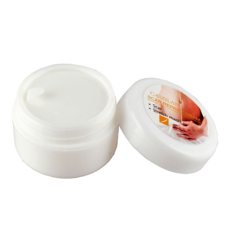 Crème réparatrice de cicatrices d'acné pour femmes enceintes, soins de la peau, 30g